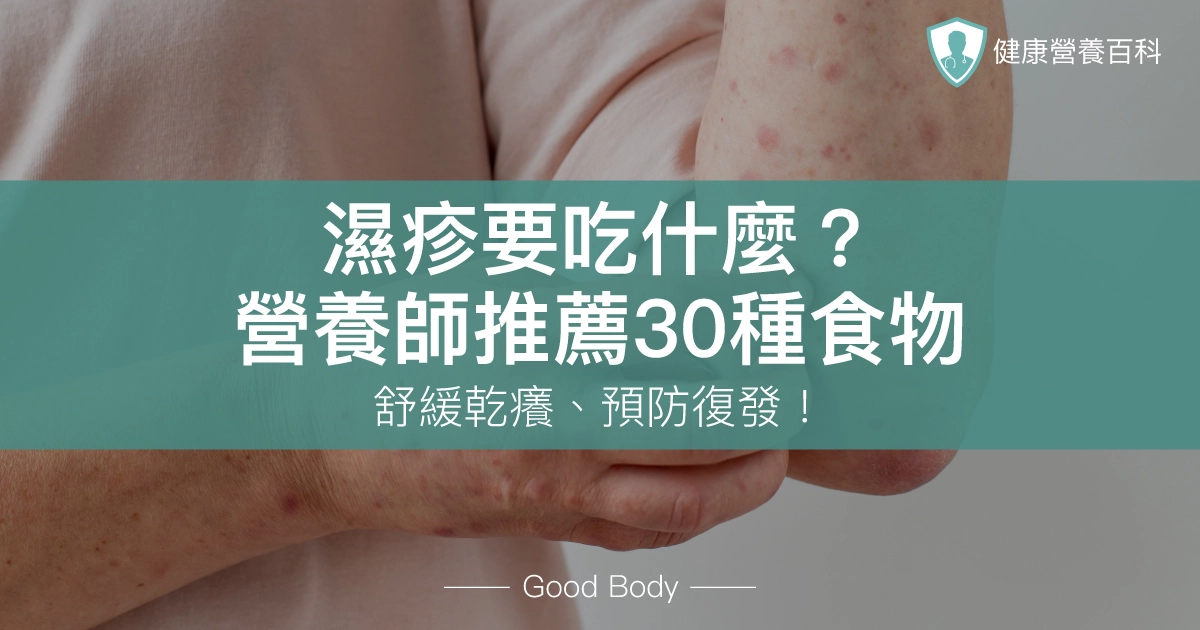 濕疹要吃什麼？營養師推薦30種食物，舒緩乾癢、預防復發！